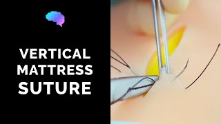 Vertical Mattress Suture  OSCE Guide  UKMLA  CPSA  PLAB 2 [upl. by Atteuqahs]