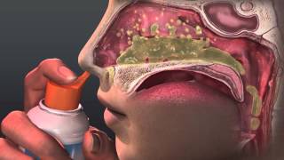 Can Saline Irrigation Help Nasal Allergies Animated Guide to Saline Nasal Irrigation [upl. by Cnahc274]