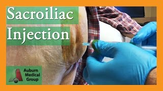 NEW SACROILIAC CORTISONE SHOT TECHNIQUE  Auburn Medical Group [upl. by Nomannic]