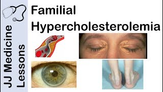 Types of Hyperlipidemia I–V – Cardiovascular Pathology  Lecturio [upl. by Annawahs]