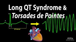 Long QT Syndrome and Torsades de Pointes Animation [upl. by Tamaru]