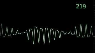 Torsades de Pointes heart monitor animation [upl. by Rusert]