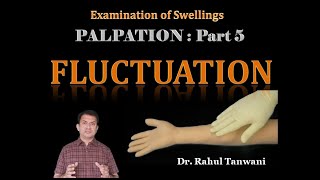 Palpation of Swellings  Part 5  Fluctuation [upl. by Itoyj]