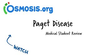 Paget Disease Osmosis Study Video [upl. by Elliot]