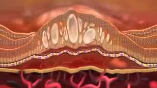 Lucentis ranibizumab [upl. by Adlev]