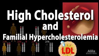 Familial Hypercholesterolemia – Genetic High Cholesterol Explained By Dr Berg [upl. by Ranitta]