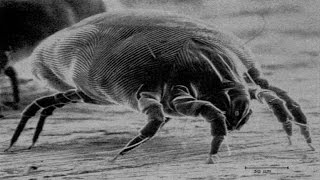 15 Ways to Get Rid of DUST MITES Quickly [upl. by Nitfa]