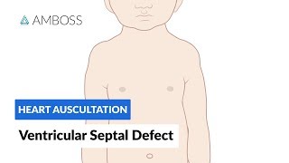 Atrial Septal Defect ASD Pathophysiology amp Clinical Features [upl. by Wallas118]