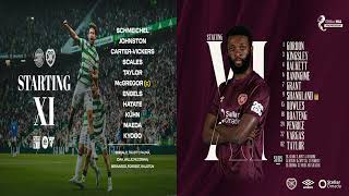 Celtic Vs Hearts BBC Radio [upl. by Guzel]