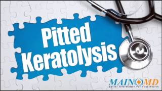 Pitted Keratoylysis ¦ Treatment and Symptoms [upl. by Jilly]