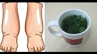 El Mejor Remedio Para Las PIERNAS HINCHADAS En Este Té de gran alcance ¡EFECTIVO [upl. by Scrivings722]