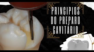 Princípios do Preparo Cavitário [upl. by Nylorahs]